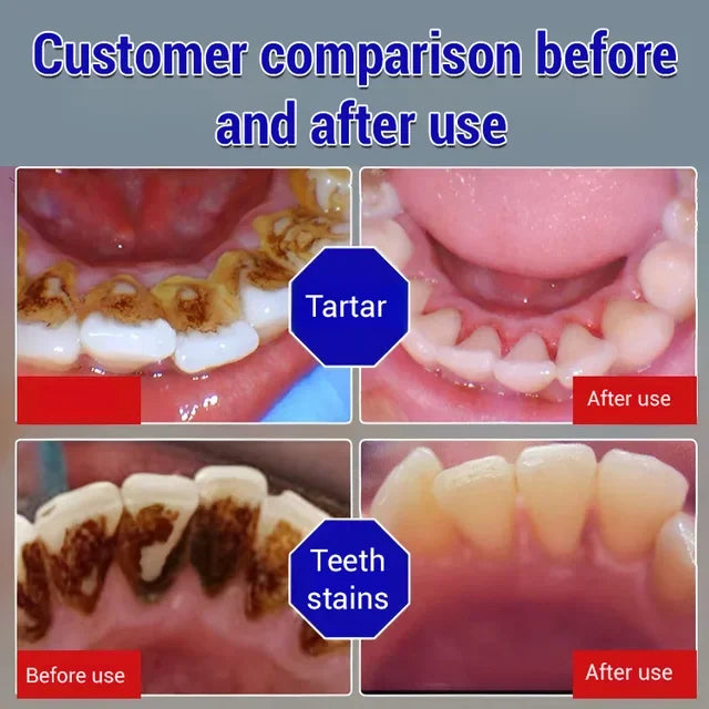 💥2024 Experts Recommend Product-Baking soda toothpaste oral care