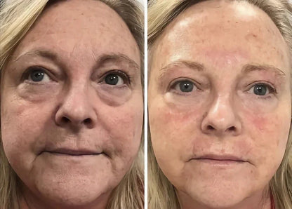 Dermatologists Are Calling This the Future of Foundation💞 🇰🇷 The #1 foundation in Korea✨