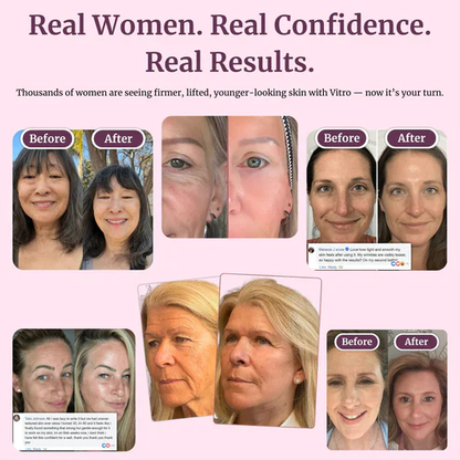 🏆 #1 Bestselling🏆-- Calcium Multi Balm 💫 Anti-Aging & Firming Korean Skincare Stick🔥