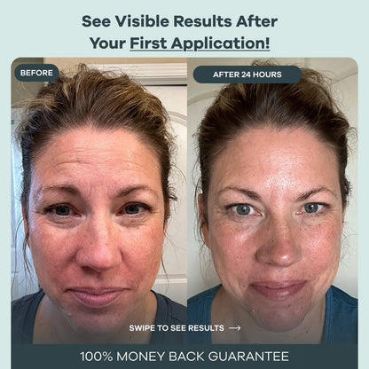 The Micro Infusion System™  Visibly Diminish Wrinkles & Sagging In 12 Weeks