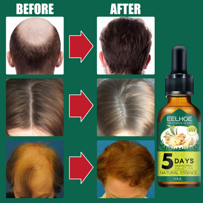 2021 New Ginger Hair Oil