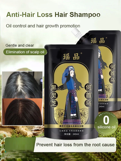 ✨Last Day Promotion🎁Hot Sale Ginger Plant Extract Anti-Hair Loss Hair Shampoo