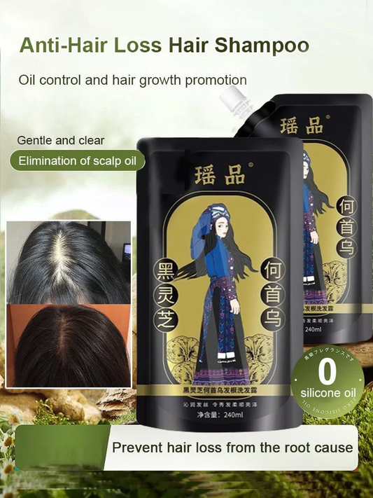 ✨Last Day Promotion🎁Hot Sale Ginger Plant Extract Anti-Hair Loss Hair Shampoo
