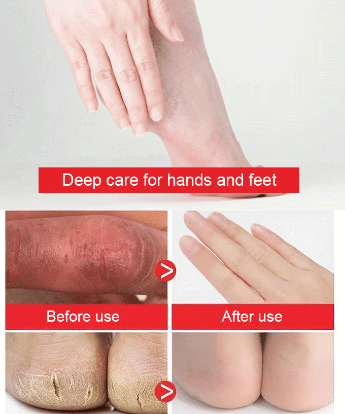 Nourishing Moisturizing Horse Oil Anti-Frostbite Anti-Cracking Hand Cream