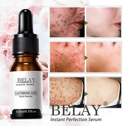 2024 New BELAY  Instant Perfection wrinkles essence